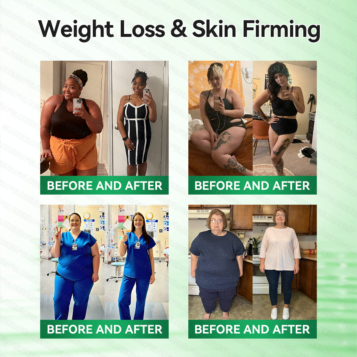 🇬🇧𝑶𝒇𝒇𝒊𝒄𝒊𝒂𝒍 𝑺𝒕𝒐𝒓𝒆  | 🥑🥑𝐆𝑳𝑶𝗥𝗘𝗡𝘿𝘼® 𝙈𝒐𝒓𝒊𝒏𝒈𝗮 · 𝗕𝗲𝗿𝗯𝐞𝐫𝐢𝐧𝙚 × 𝙉𝑨𝑫+ 𝟏𝟎-𝙞𝙣-1 𝘼𝒅𝒗𝒂𝒏𝒄𝒆𝐝 𝐍𝐚𝐧𝙤 𝙈𝙞𝙘𝙧𝙤𝙣𝒆𝒆𝒅𝒍𝐞 𝐏𝐚𝐭𝙘𝙝(𝐉𝐮𝐬𝐭 𝐨𝐧𝐜𝐞 𝐚 𝐝𝐚𝐲, 𝐯𝐢𝐬𝐢𝐛𝐥𝐞 𝐜𝐡𝐚𝐧𝐠𝐞𝐬 𝐢𝐧 𝟕 𝐝𝐚𝐲𝐬） ✅ 𝐅𝐨𝐫 𝐨𝐛𝐞𝐬𝐢𝐭𝐲, 🅛🅞🅞🅢🅔 🅢🅚🅘🅝,𝐝𝐢𝐚𝐛𝐞𝐭𝐞𝐬, 𝐬𝐥𝐞𝐞𝐩 𝐚𝐩𝐧𝐞𝐚, 𝐣𝐨𝐢𝐧𝐭 𝐢𝐬𝐬𝐮𝐞𝐬, 𝐚𝐧𝐝 𝐦𝐨𝐫𝐞